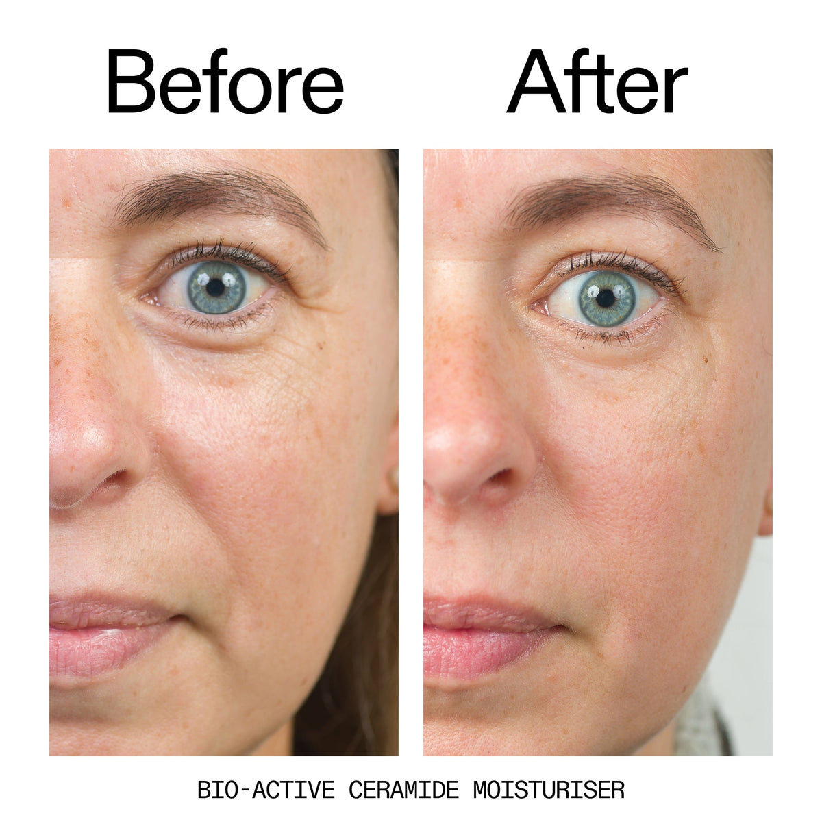 barrier-boosting-trio-a0 Bio-Active_Before_After_2000x2000_600947b4-e8c5-425a-9155-fc15bc83aa12.jpg