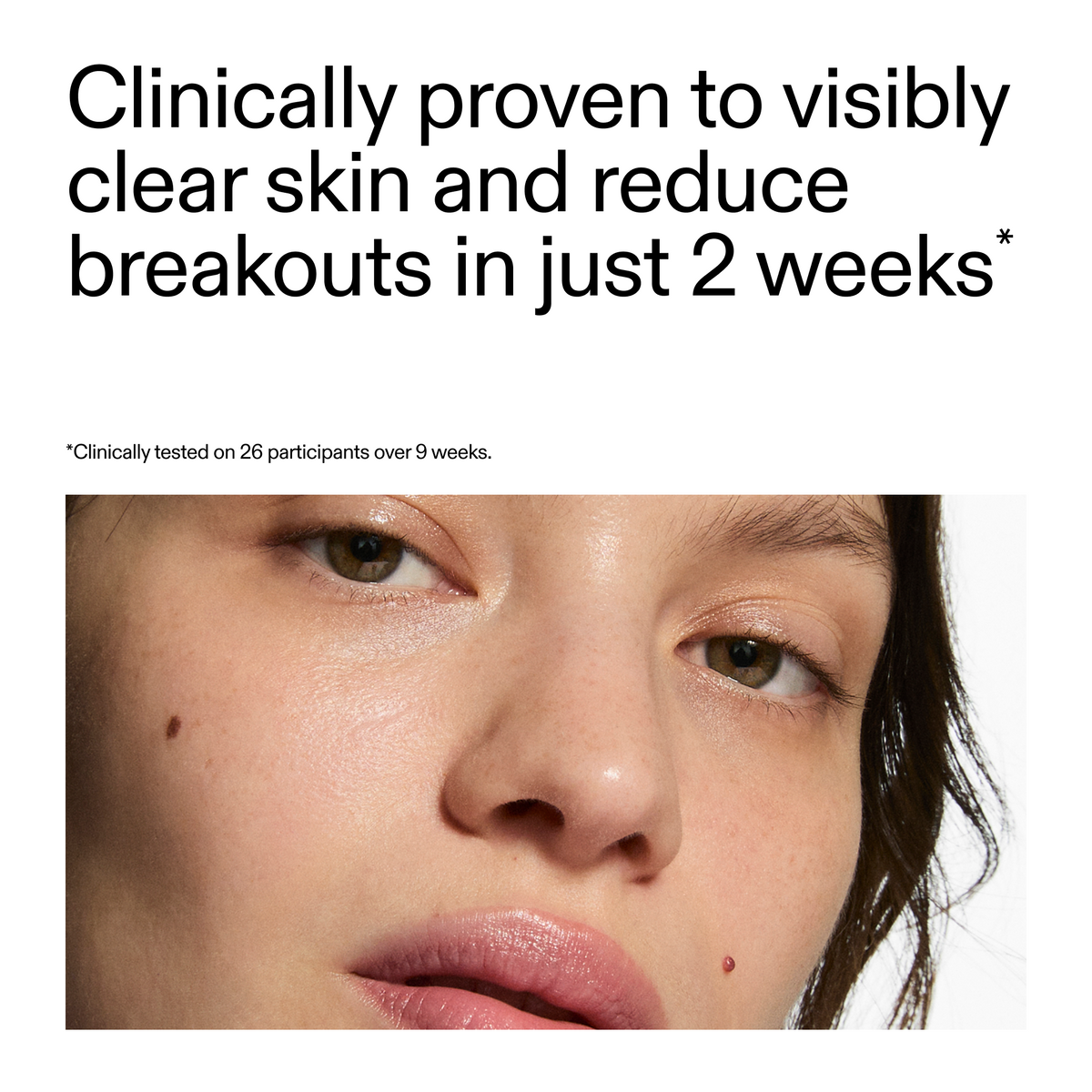 360-acne-clearing-duo-g7 360_Serum_Key_Claim.png