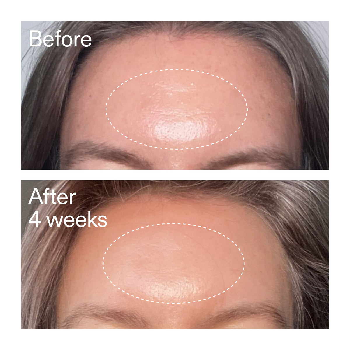 advanced-0-2-retinal-serum-x1 AdvancedRetinal_BeforeAfter1_2000x2000_1da6bb0a-29dd-41d1-95b7-8679696bbf0f.jpg