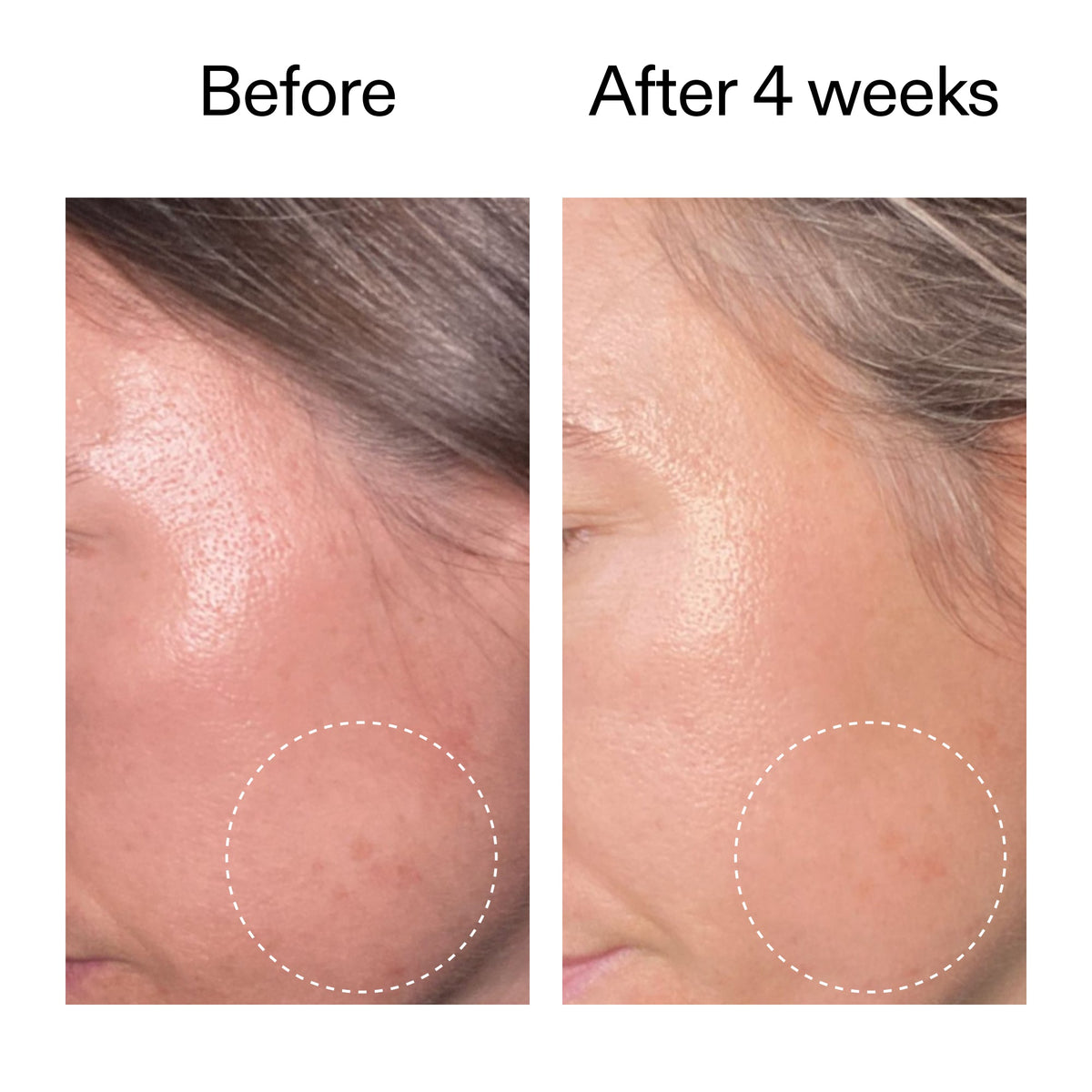 advanced-0-2-retinal-serum-x1 AdvancedRetinal_BeforeAfter2__2000x2000_62fb16bb-77ae-4d63-8500-88dbf847f4b9.jpg