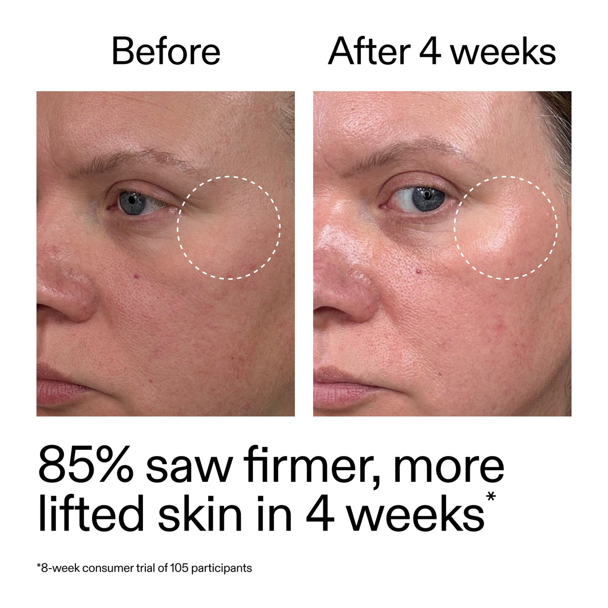 advanced-0-2-retinal-serum-duo-v7 AdvancedRetinal_BeforeAfter_Claim1_2000x2000_3a315aa8-f408-4b33-bbeb-0d9209f98404.jpg