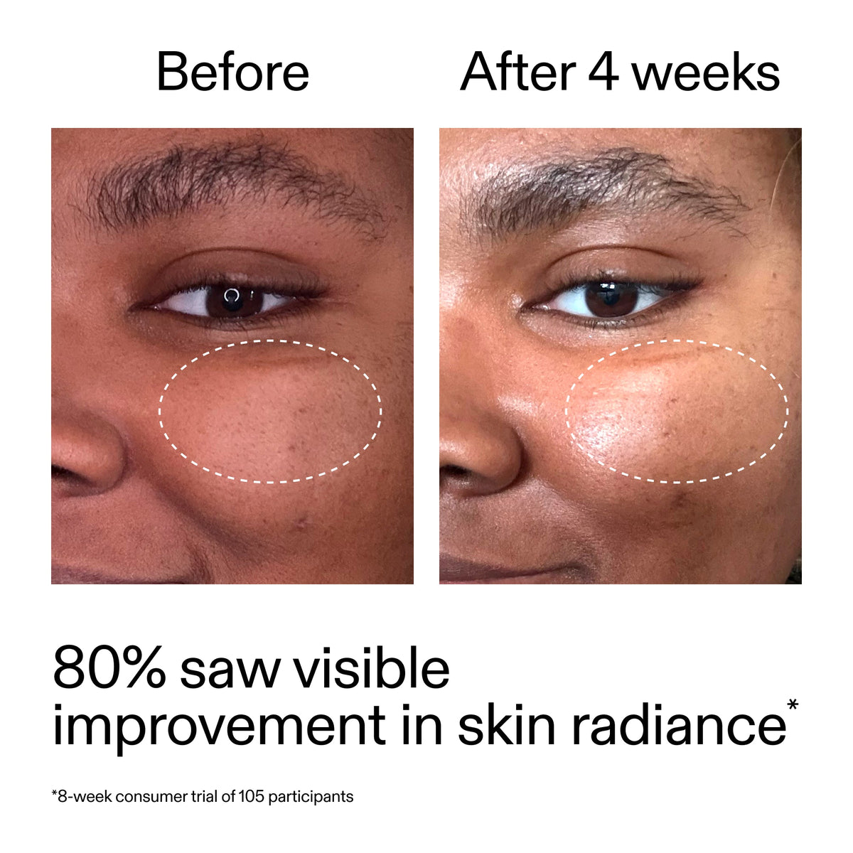 advanced-0-2-retinal-serum-x1 AdvancedRetinal_BeforeAfter_Claim2_2000x2000_39d11e3d-eda9-44ec-ab32-2903b1a368bd.jpg