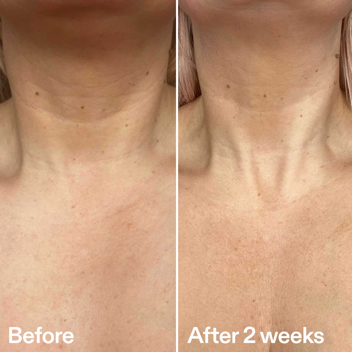 bio-active-neck-lift-stick-p9 B_A_2.jpg