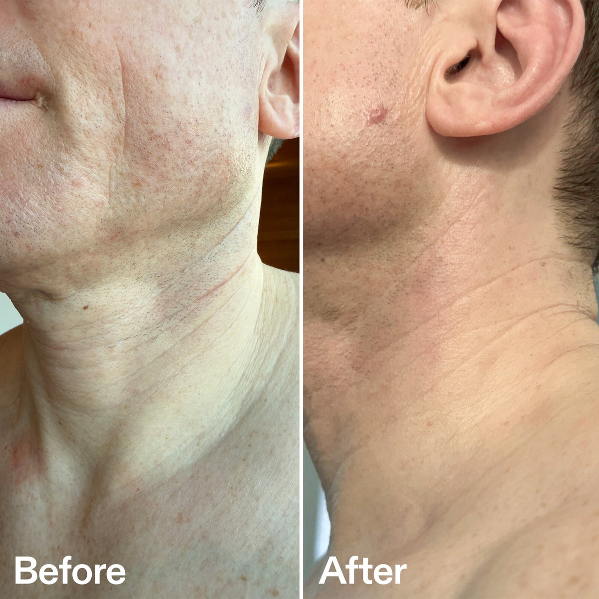 bio-active-neck-lift-stick-p9 B_A_afa2743e-b8e2-4504-92f4-e281cb6cf759.jpg