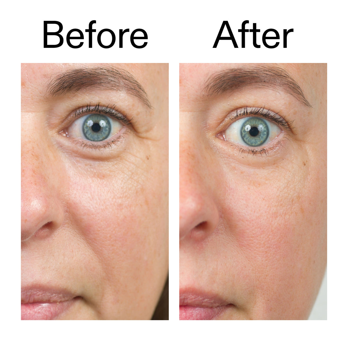 bio-active-ceramide-moisturizer-t3 Bio-Active_Before_After_2000x2000_566e5a9e-135e-417a-8242-b44e5fa35463.jpg
