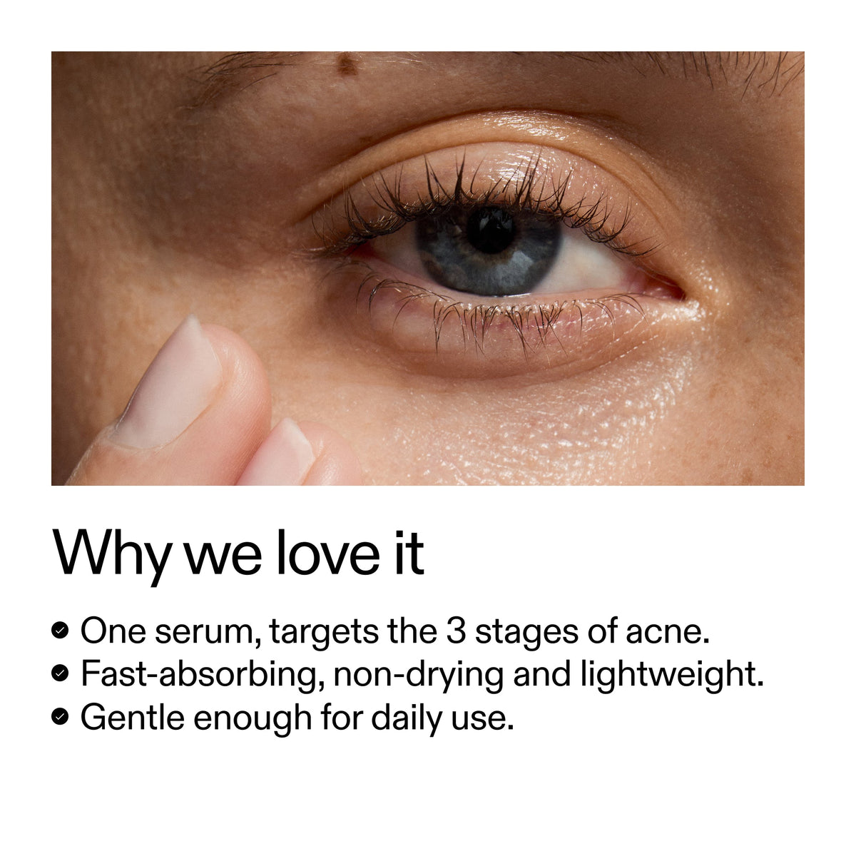 360-acne-clearing-serum-v0 Dioic_Whyweloveit_2000x2000_175aafd3-0cbe-403a-b317-a8362881bfe2.jpg