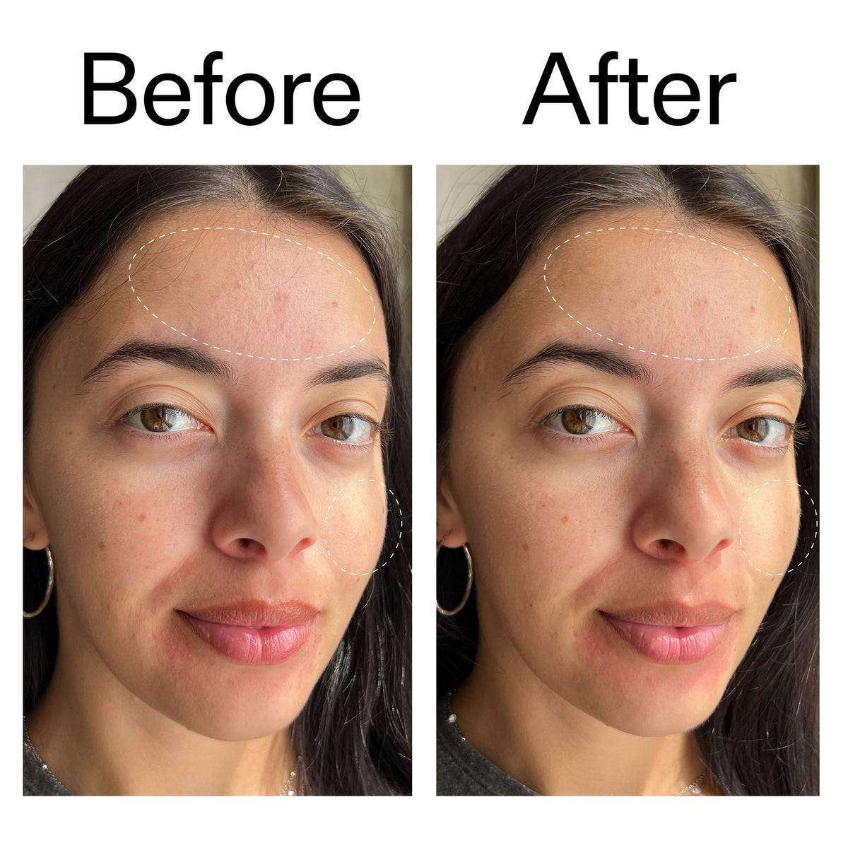 glycerin-gentle-purifying-cleanser-s2 Glycerin_B_A_2000x2000_19037705-c220-4333-99c1-e648cc3ac1d7.jpg