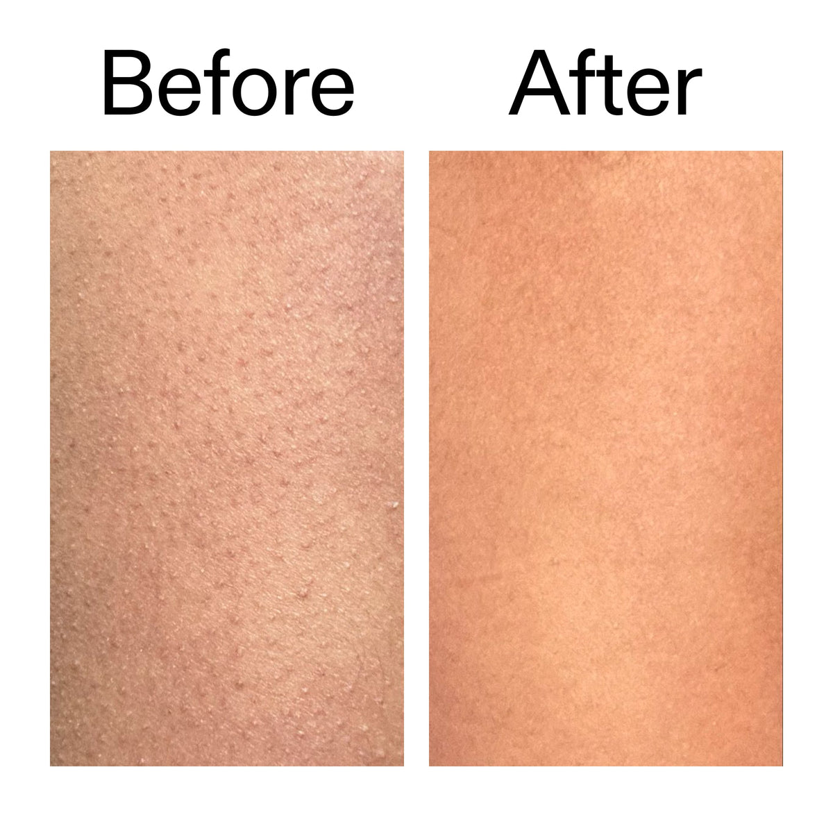 glycolic-acid-exfoliating-body-stick-duo-x8 Glycolic_Body_Stick_B_A_2000x2000_6e6e6b4d-5bd7-43c0-aeed-4d66788e8995.jpg