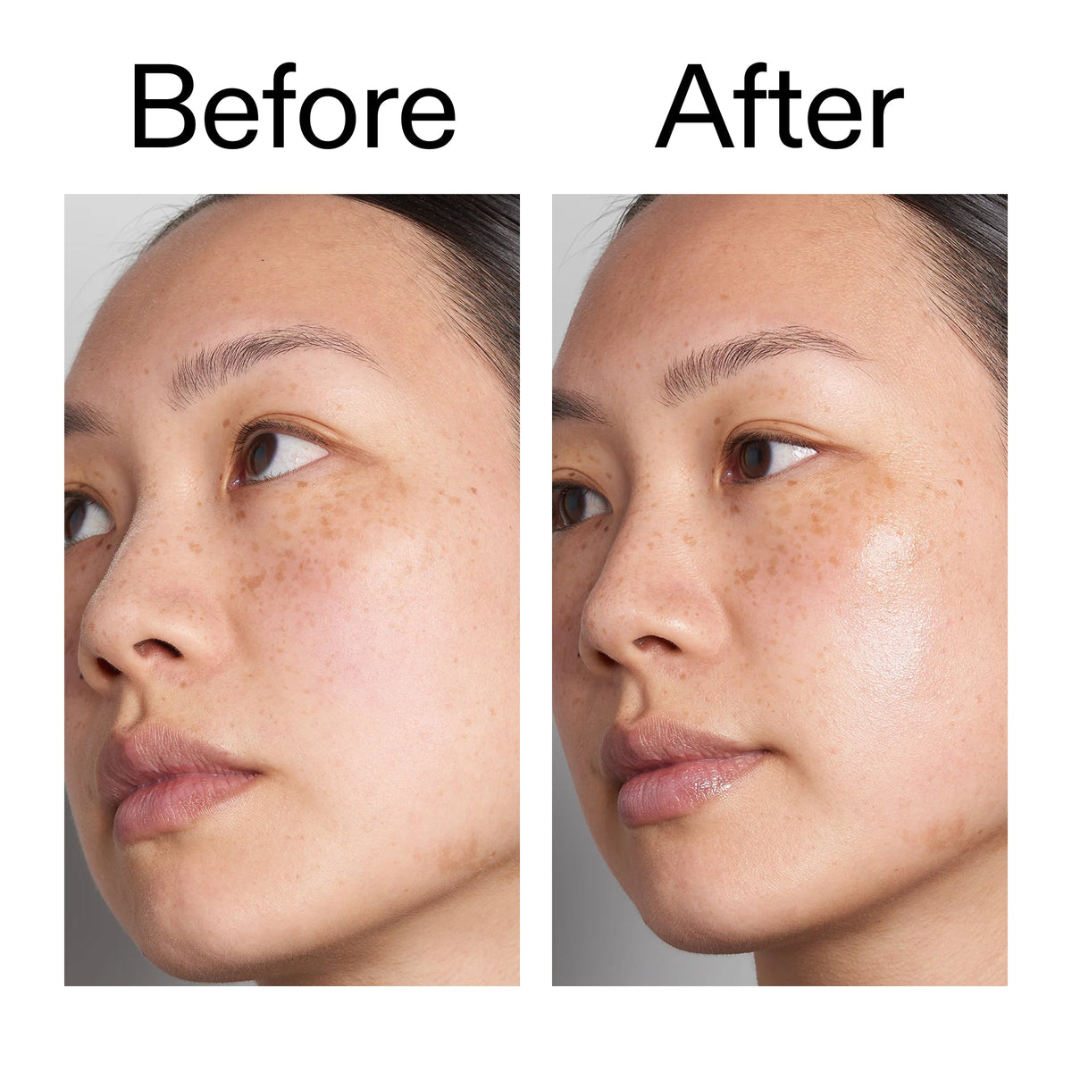 supersize-hyaluronic-acid-serum-100ml-duo-b6 Hyaluronic_Acid_Before_After_2000x2000_d7983956-8aa2-4ea3-8255-c63e8d4f892e.jpg