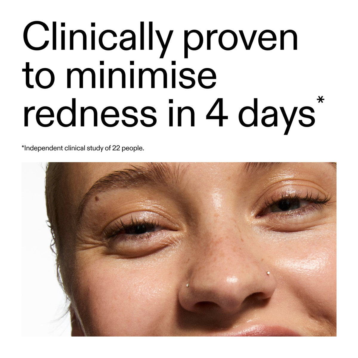 10-azelaic-acid-serum-for-redness-relief-h6 Oat_Cleansing_Balm_Claim_2000x2000_52a841dc-353c-4f2c-8646-3aadb604507d.jpg