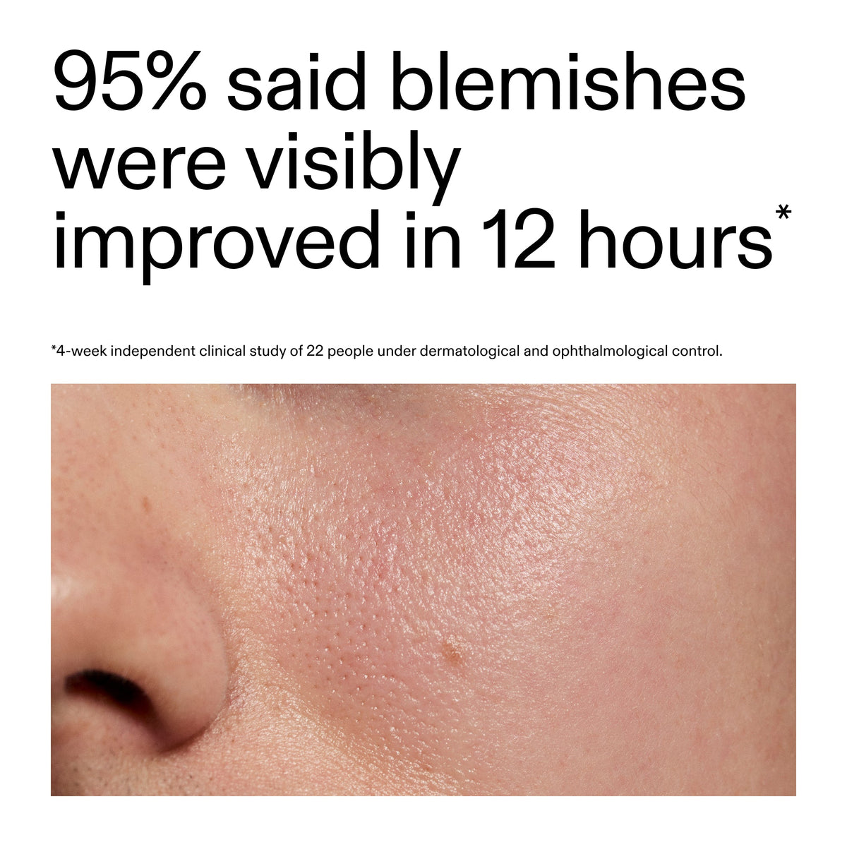 succinic-acid-acne-treatment-s0 Oat_Cleansing_Balm_Claim_2000x2000_ac6ce553-25db-41b2-a981-faae1ac4b8c0.jpg