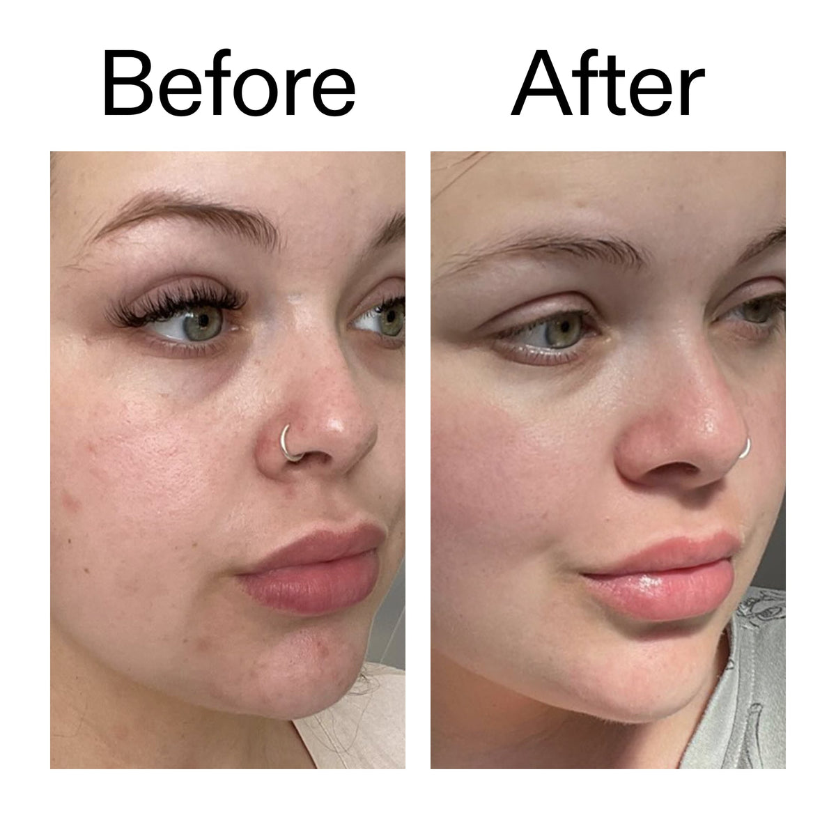 supersize-omega-water-cream-100ml-s8 Omega50_Before_After_2000x2000_46483ed8-3f9d-487f-9a0c-9df79830bd65.jpg