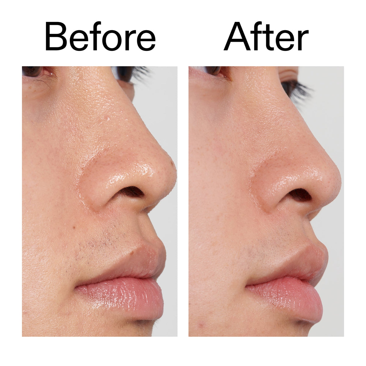 pha-toner-v5 PHA_Toner_Before_After_2000x2000_e3c10172-0150-4342-8b95-57417eaff50d.jpg