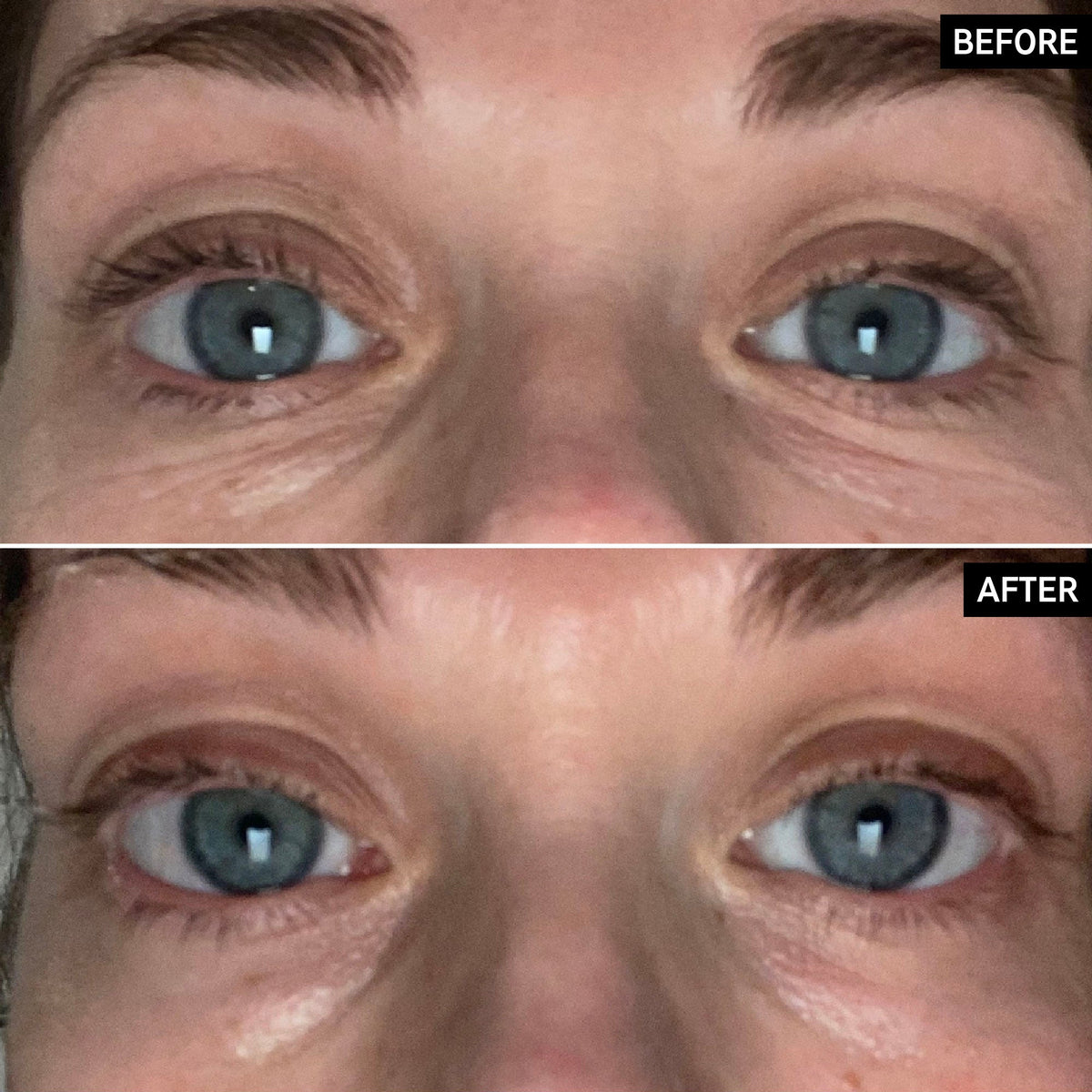 retinol-eye-cream-i5 SITE-UGCBAsApril_Nicole_B_A_PPage_2000x2000_1.jpg