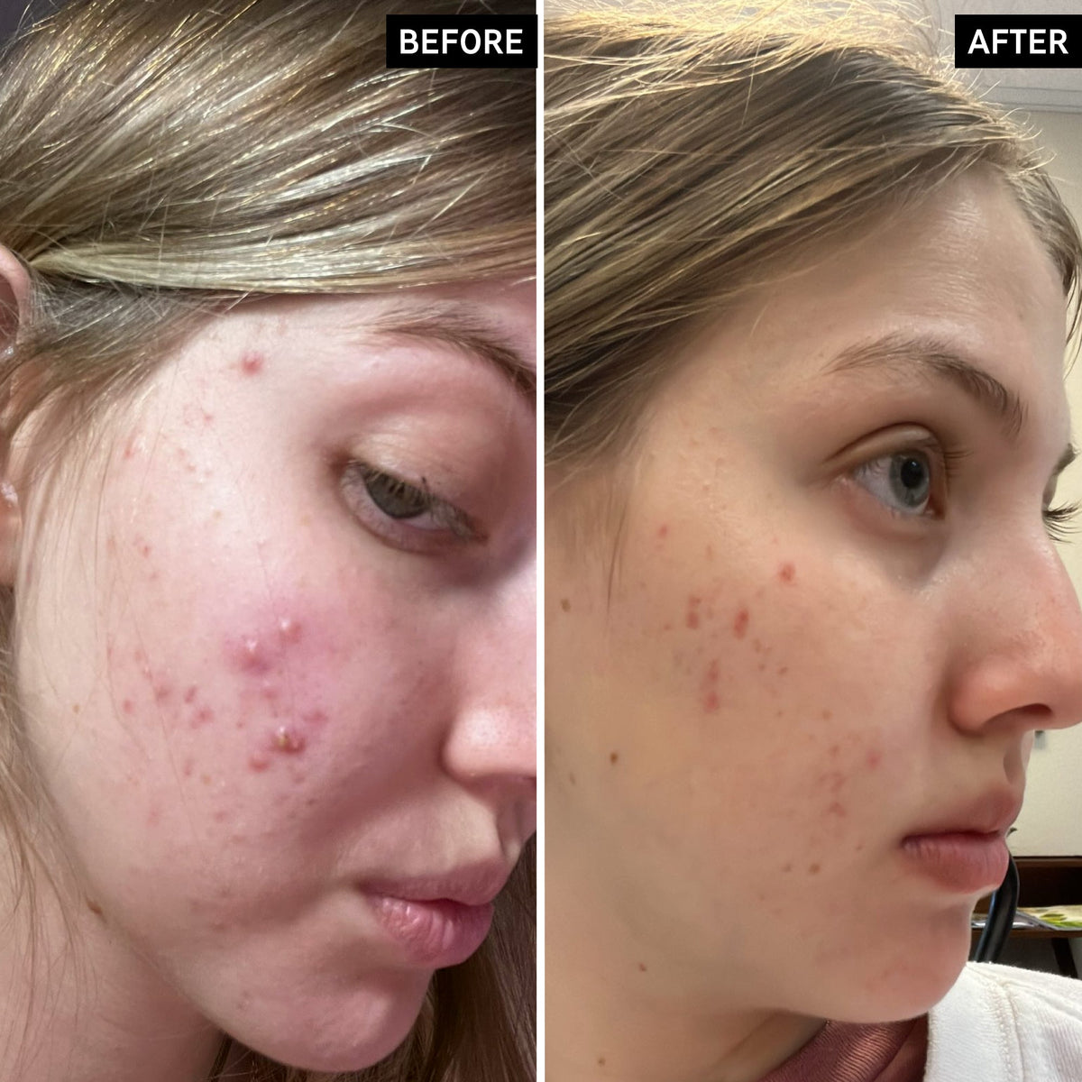 salicylic-acid-cleanser-150ml-h8 SamanthaB_A_2000x2000_54062586-cec1-44d9-a20a-bda2c4f03f5f.jpg