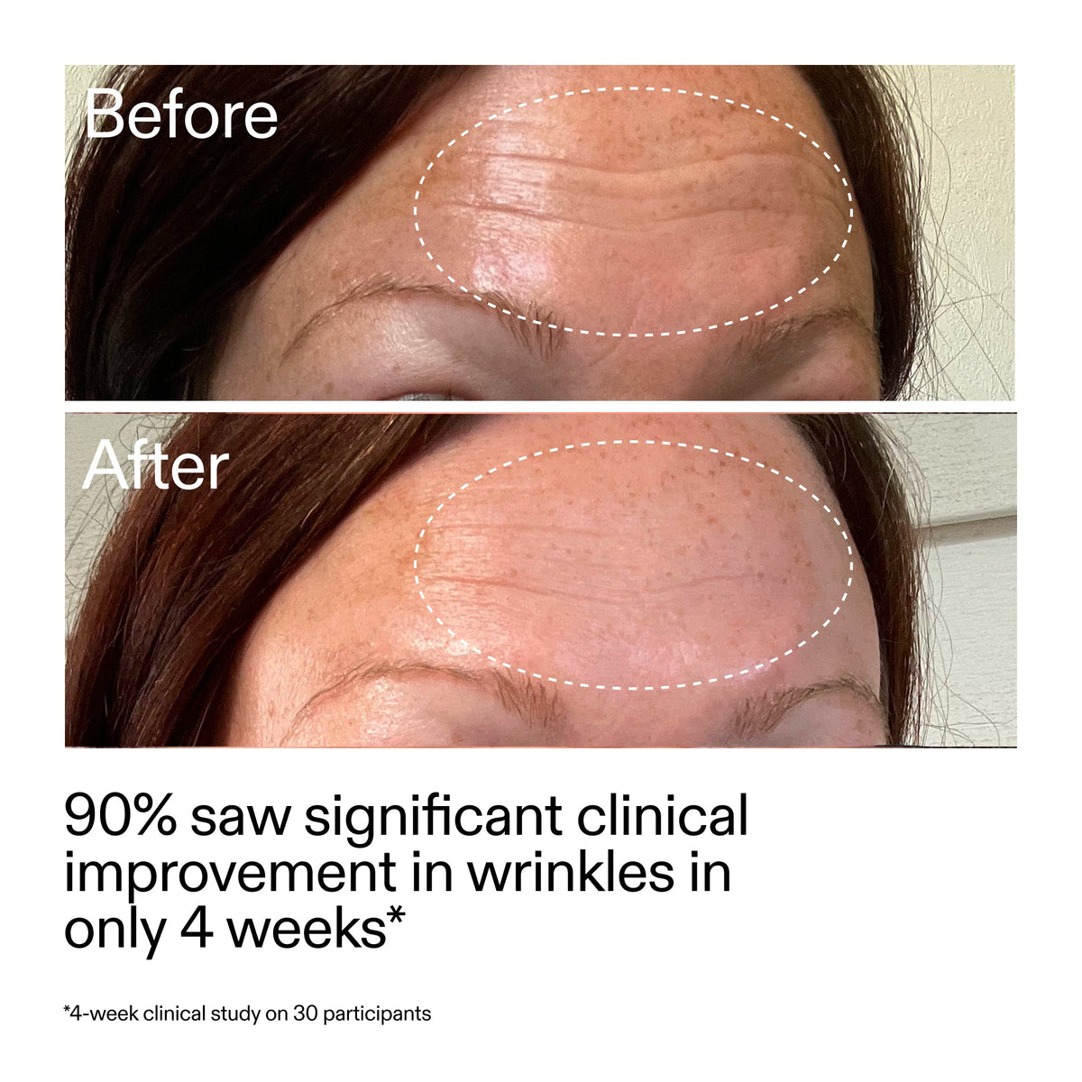 starter-retinol-serum-duo-y1 StarterRetinol_BeforeAfter_Claim1_2000x2000_03b4d6e5-a357-43b9-a855-aba5e35c57f3.jpg