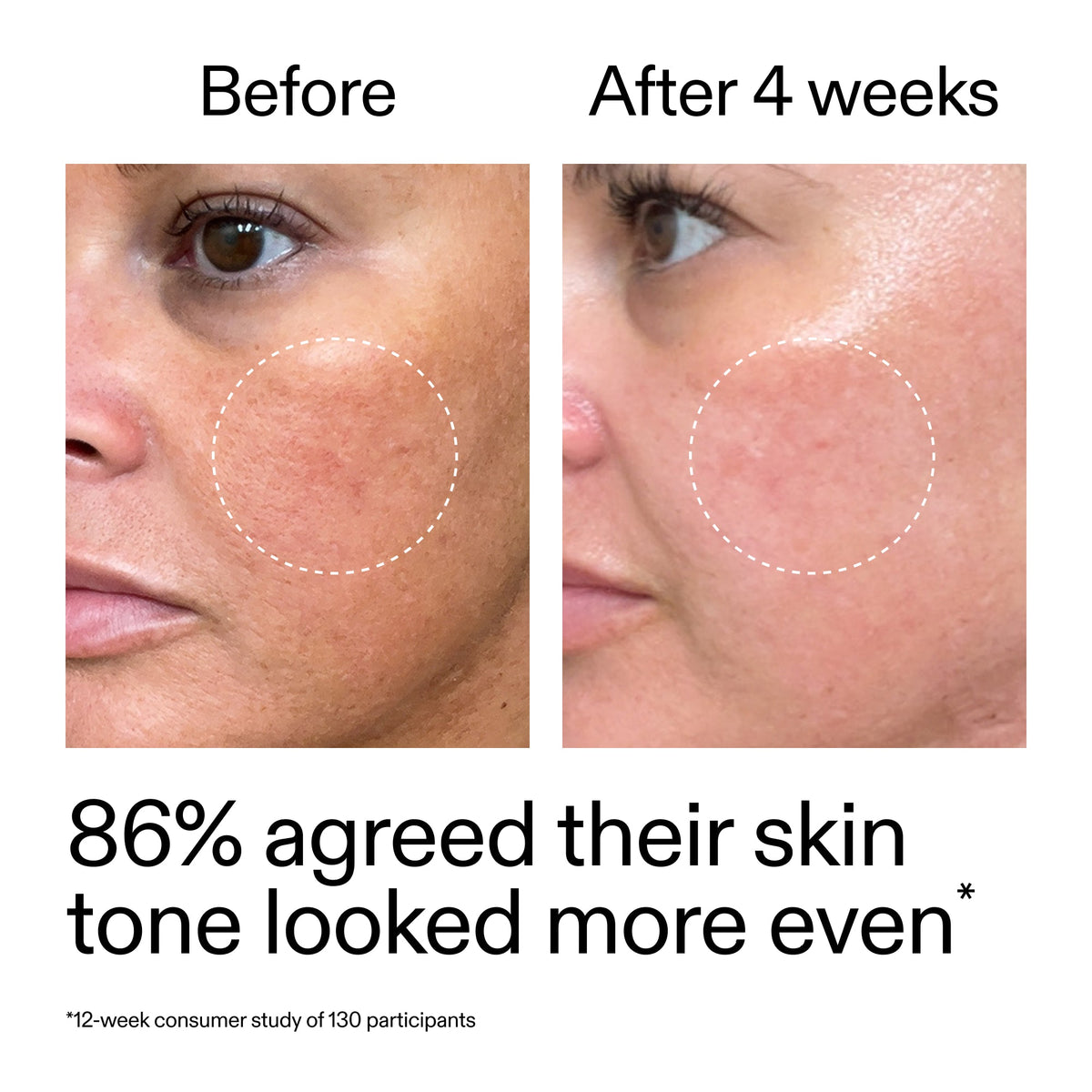 starter-retinol-serum-duo-y1 StarterRetinol_BeforeAfter_Claim2_2000x2000_fc5bb8ac-8588-478f-98d5-28af6651601a.jpg