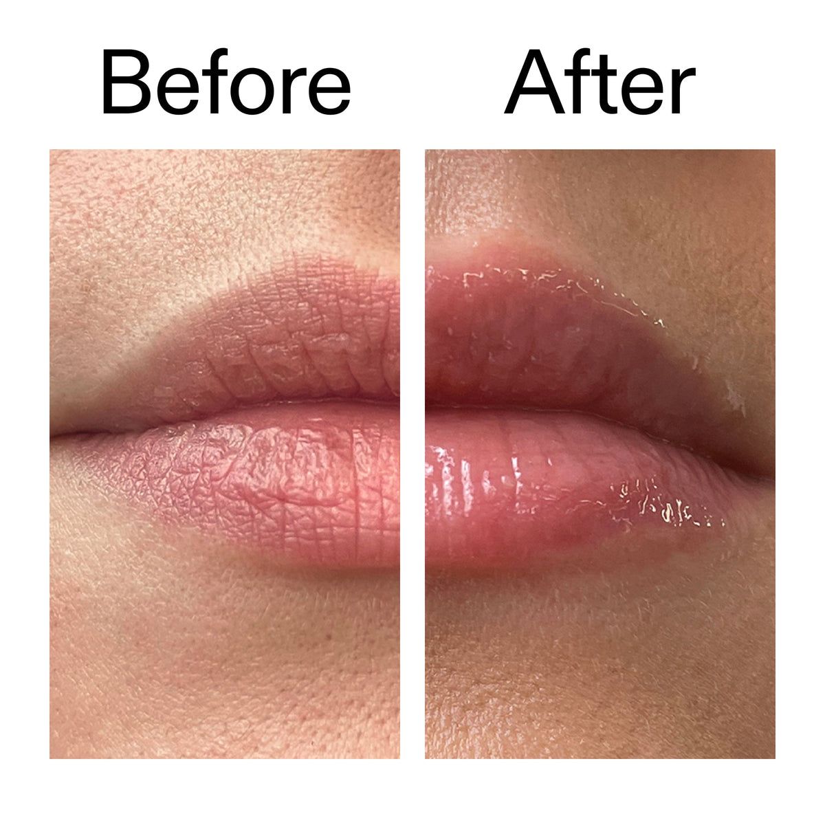 lip-plumping-duo-j9 Tripeptide_Plumping_Lip_Balm_Before_After_2000x2000_b4a5ee04-d2ac-4857-8f01-17209acc4bf3.jpg